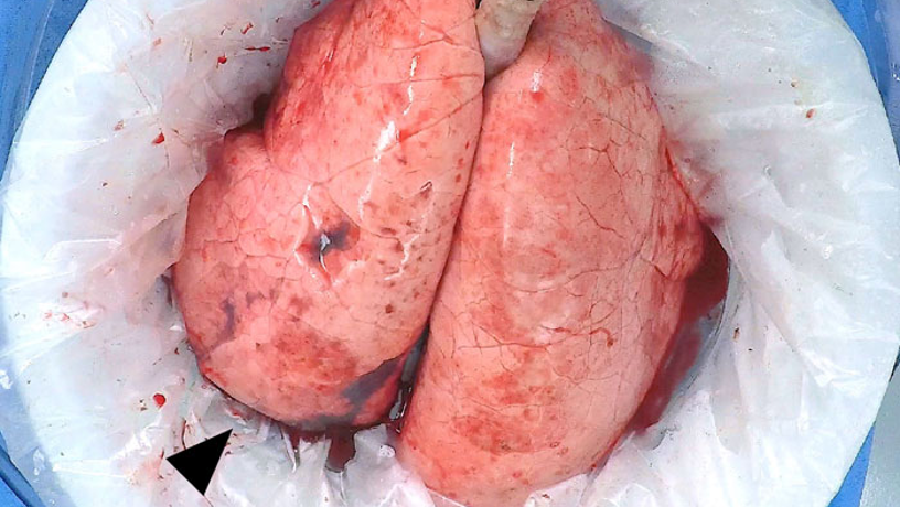 Lungs regenerated ex vivo.