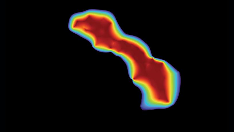 measure ablation lesion dimensions to treat cardiac arrhythmias